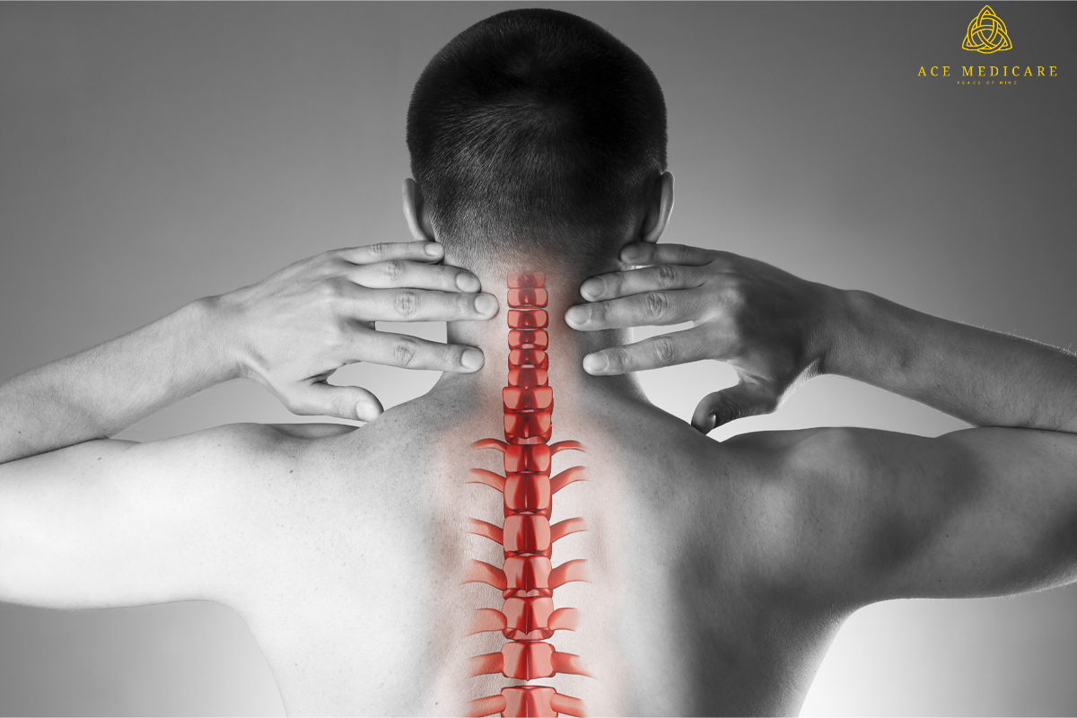 Common Misconceptions About Spinal Surgery Debunked
